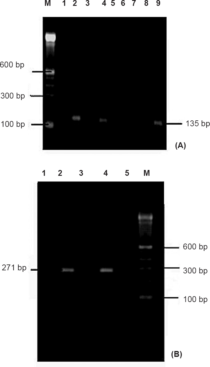 (A). Nested RT-PCR of samples targeting NSP 3 gene region; Lane M: Molecular weight marker, Lanes 1, 3, 5-8: Negative control, Lanes 2, 4: Chikungunya positive samples, Lane 9: Positive control. (B). Nested RT-PCR of samples targeting E-3 gene region; Lane M: Molecular weight marker, Lanes 1, 3, 5: Negative control, Lane 2: Chikungunya positive samples, Lane 4: Positive control.